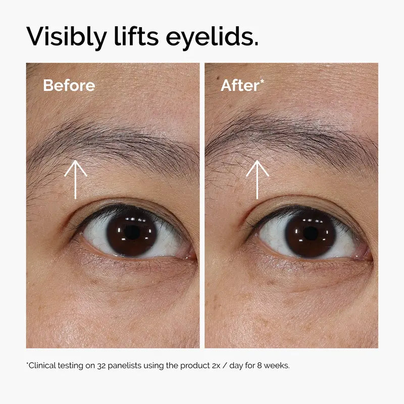 Lacto-PDRN 4% + B9 Firming & Brightening Eye Cream for Fine Lines & Dark Circles | Buy 2 Get 1 Free