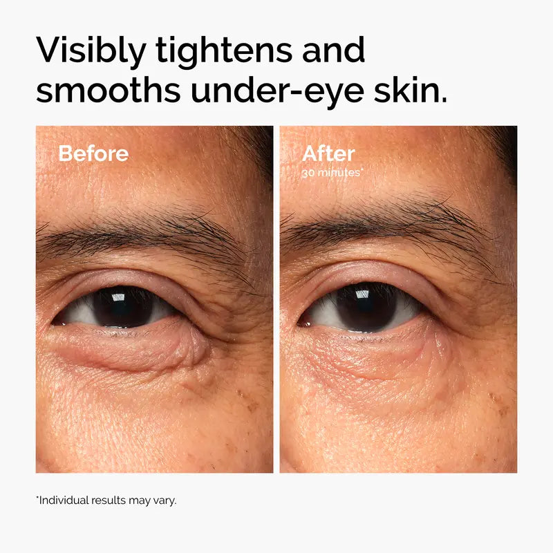 Lacto-PDRN 4% + B9 Firming & Brightening Eye Cream for Fine Lines & Dark Circles | Buy 2 Get 1 Free